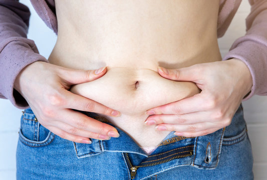 Fat Belly: How To Lose Belly Fat